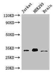 Western Blot Positive WB detected in: Jurkat whole cell lysate, HEK293 whole cell lysate, Mouse brain tissue All lanes: MBD3 antibody at 3µg/ml Secondary Goat polyclonal to rabbit IgG at 1/50000 dilution Predicted band size: 33, 30 kDa Observed ba...