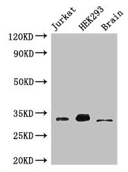 Western Blot Positive WB detected in: Jurkat whole cell lysate, HEK293 whole cell lysate, Mouse brain tissue All lanes: MBD3 antibody at 3µg/ml Secondary Goat polyclonal to rabbit IgG at 1/50000 dilution Predicted band size: 33, 30 kDa Observed ba...