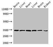 Western Blot Positive WB detected in: Rat brain tissue, Rat liver tissue, Mouse heart tissue, Mouse liver tissue, Mouse brain tissue, Mouse kidney tissue All lanes: MBP antibody at 4ug/ml Secondary Goat polyclonal to rabbit IgG at 1/50000 dilution...