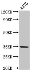 Western Blot Positive WB detected in: A375 whole cell lysate All lanes: MC1R antibody at 4µg/ml Secondary Goat polyclonal to rabbit IgG at 1/50000 dilution Predicted band size: 35 kDa Observed band size: 35 kDa
