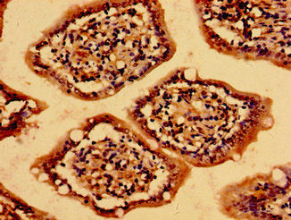 Immunohistochemistry of paraffin-embedded human small intestine tissue using CSB-PA013561LA01HU at dilution of 1:100