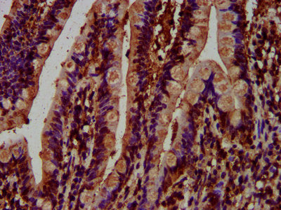 IHC image of CSB-PA013571LA01HU diluted at 1:500 and staining in paraffin-embedded human small intestine tissue performed on a Leica BondTM system. After dewaxing and hydration, antigen retrieval was mediated by high pressure in a citrate buffer (...