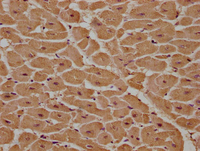 IHC image of CSB-PA013579LA01HU diluted at 1:100 and staining in paraffin-embedded human heart tissue performed on a Leica BondTM system. After dewaxing and hydration, antigen retrieval was mediated by high pressure in a citrate buffer (pH 6.0). S...