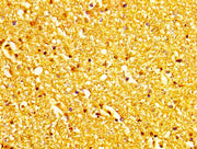 IHC image of CSB-PA013585LA01HU diluted at 1:200 and staining in paraffin-embedded human brain tissue performed on a Leica BondTM system. After dewaxing and hydration, antigen retrieval was mediated by high pressure in a citrate buffer (pH 6.0). S...