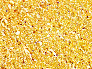 IHC image of CSB-PA013585LA01HU diluted at 1:200 and staining in paraffin-embedded human brain tissue performed on a Leica BondTM system. After dewaxing and hydration, antigen retrieval was mediated by high pressure in a citrate buffer (pH 6.0). S...