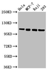 Western Blot Positive WB detected in: Hela whole cell lysate, MCF-7 whole cell lysate, Raji whole cell lysate, 293 whole cell lysate All lanes: MCM2 antibody at 4.8µg/ml Secondary Goat polyclonal to rabbit IgG at 1/50000 dilution Predicted band si...