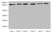 Western blot All lanes: MCM3 antibody at 4 ug/ml Lane 1: Hela whole cell lysate Lane 2: 293T whole cell lysate Lane 3: K562 whole cell lysate Lane 4: HepG2 whole cell lysate Lane 5: Jurkats whole cell lysate Lane 6: U917 whole cell lysate Secondar...