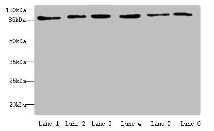Western blot All lanes: MCM3 antibody at 4 ug/ml Lane 1: Hela whole cell lysate Lane 2: 293T whole cell lysate Lane 3: K562 whole cell lysate Lane 4: HepG2 whole cell lysate Lane 5: Jurkats whole cell lysate Lane 6: U917 whole cell lysate Secondar...