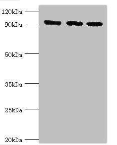 Western blot All lanes: DNA replication licensing factor MCM3 antibody at 8ug/ml Lane 1: Hela whole cell lysate Lane 2: K562 whole cell lysate Lane 3: 293T whole cell lysate Secondary Goat polyclonal to rabbit IgG at 1/10000 dilution Predicted ban...