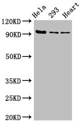 Western Blot Positive WB detected in: Hela whole cell lysate, 293 whole cell lysate, Rat heart tissue All lanes: MCM4 antibody at 2.7µg/ml Secondary Goat polyclonal to rabbit IgG at 1/50000 dilution Predicted band size: 97 kDa Observed band size:...