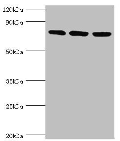 Western blot All lanes: DNA replication licensing factor MCM5 antibody at 3ug/ml Lane 1: Hela whole cell lysate Lane 2: MCF-7 whole cell lysate Lane 2: Mouse thymus tissue Secondary Goat polyclonal to rabbit IgG at 1/10000 dilution Predicted band...