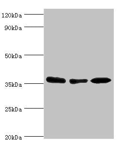 Western blot All lanes: MDH1 antibody at 4ug/ml Lane 1: HepG2 whole cell lysate Lane 2: Hela whole cell lysate Lane 3: Mouse kidney tissue Secondary Goat polyclonal to rabbit IgG at 1/10000 dilution Predicted band size: 37, 28, 39 kDa Observed ban...