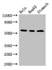 Western Blot Positive WB detected in: Hela whole cell lysate, HepG2 whole cell lysate, Mouse stomach tissue All lanes: MDM4 antibody at 3µg/ml Secondary Goat polyclonal to rabbit IgG at 1/50000 dilution Predicted band size: 55, 15, 14, 19, 50 kDa...
