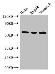Western Blot Positive WB detected in: Hela whole cell lysate, HepG2 whole cell lysate, Mouse stomach tissue All lanes: MDM4 antibody at 3µg/ml Secondary Goat polyclonal to rabbit IgG at 1/50000 dilution Predicted band size: 55, 15, 14, 19, 50 kDa...
