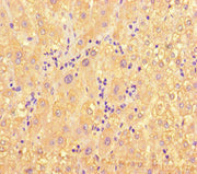 Immunohistochemistry of paraffin-embedded human liver tissue using CSB-PA013632LA01HU at dilution of 1:100