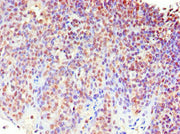 Immunohistochemistry of paraffin-embedded human tonsil tissue using CSB-PA013638ESR2HU at dilution of 1:100
