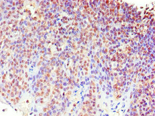 Immunohistochemistry of paraffin-embedded human tonsil tissue using CSB-PA013638ESR2HU at dilution of 1:100
