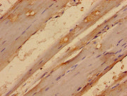 Immunohistochemistry analysis of human skeletal muscle tissue using CSB-PA013657LA01HU at dilution of 1:100