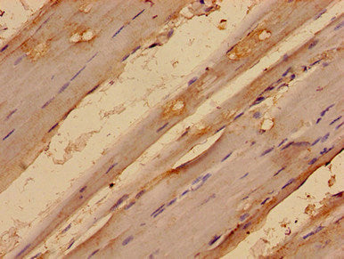 Immunohistochemistry analysis of human skeletal muscle tissue using CSB-PA013657LA01HU at dilution of 1:100