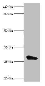 Western blot All lanes: MED6 antibody at 8ug/ml + Jurkat whole cell lysate Secondary Goat polyclonal to rabbit IgG at 1/10000 dilution Predicted band size: 29, 30, 21 kDa Observed band size: 29 kDa