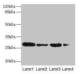 Western blot All lanes: MED7 antibody at 6µg/ml Lane 1: Jurkat whole cell lysate Lane 2: Hela whole cell lysate Lane 3: Mouse thymus tissue Lane 4: NIH/3T3 whole cell lysate Secondary Goat polyclonal to rabbit IgG at 1/10000 dilution Predicted ban...