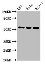 Western Blot Positive WB detected in: U87 whole cell lysate, Hela whole cell lysate, MCF-7 whole cell lysate All lanes: MEF2A antibody at 1:500 Secondary Goat polyclonal to rabbit IgG at 1/50000 dilution Predicted band size: 55, 54, 47, 46 kDa Obs...