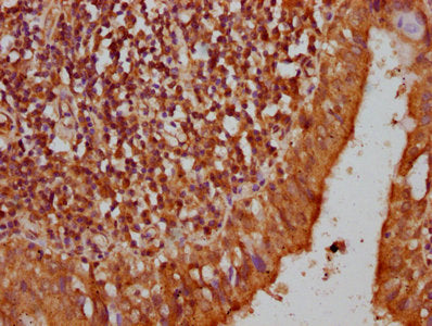 IHC image of CSB-PA013675LA01HU diluted at 1:200 and staining in paraffin-embedded human lung tissue performed on a Leica BondTM system. After dewaxing and hydration, antigen retrieval was mediated by high pressure in a citrate buffer (pH 6.0). Se...