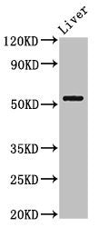 Western Blot Positive WB detected in: Mouse liver tissue All lanes: MEIS2 antibody at 3ug/ml Secondary Goat polyclonal to rabbit IgG at 1/50000 dilution Predicted band size: 52, 44, 33, 34, 42, 43 kDa Observed band size: 52 kDa