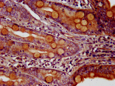 IHC image of CSB-PA013689LA01HU diluted at 1:200 and staining in paraffin-embedded human small intestine tissue performed on a Leica BondTM system. After dewaxing and hydration, antigen retrieval was mediated by high pressure in a citrate buffer (...
