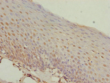 Immunohistochemistry of paraffin-embedded human tonsil tissue using CSB-PA013695ESR1HU at dilution of 1:100