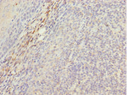 Immunohistochemistry of paraffin-embedded human tonsil tissue using CSB-PA013695ESR2HU at dilution of 1:100