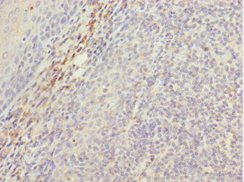 Immunohistochemistry of paraffin-embedded human tonsil tissue using CSB-PA013695ESR2HU at dilution of 1:100