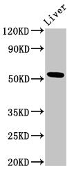 Western Blot Positive WB detected in: Rat liver tissue All lanes: METAP2 antibody at 3ug/ml Secondary Goat polyclonal to rabbit IgG at 1/50000 dilution Predicted band size: 53, 52, 51 kDa Observed band size: 53 kDa