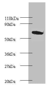 Western blot All lanes: Proteasome subunit beta type-4 Antibody at 2µg/ml + EC109 whole cell lysate Secondary Goat polyclonal to rabbit IgG at 1/15000 dilution Predicted band size: 30 kDa Observed band size: 75 kDa