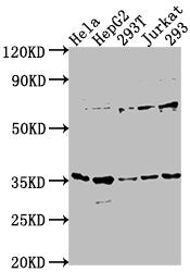 Western Blot Positive WB detected in: Hela whole cell lysate, HepG2 whole cell lysate, 293T whole cell lysate, Jurkat whole cell lysate, 293 whole cell lysate All lanes: MFF antibody at 1:1000 Secondary Goat polyclonal to rabbit IgG at 1/50000 dil...