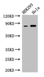 Western Blot Positive WB detected in: HEK293 whole cell lysate, Hela whole cell lysate All lanes: MELTF antibody at 3µg/ml Secondary Goat polyclonal to rabbit IgG at 1/50000 dilution Predicted band size: 81, 33 kDa Observed band size: 81 kDa