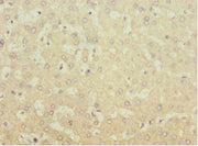 Immunohistochemistry of paraffin-embedded human liver tissue using CSB-PA013773ESR2HU at dilution of 1:100