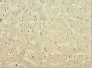 Immunohistochemistry of paraffin-embedded human liver tissue using CSB-PA013773ESR2HU at dilution of 1:100