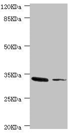 Western blot All lanes: MGLL antibody at 2.37ug/ml Lane 1: Mouse liver tissue Lane 2: HT-29 whole cell lysate Secondary Goat polyclonal to rabbit IgG at 1/10000 dilution Predicted band size: 34, 32 kDa Observed band size: 34 kDa