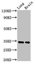 Western Blot Positive WB detected in: Rat lung tissue, Mouse brain tissue All lanes: Mgll antibody at 2.8µg/ml Secondary Goat polyclonal to rabbit IgG at 1/50000 dilution Predicted band size: 34 kDa Observed band size: 34 kDa
