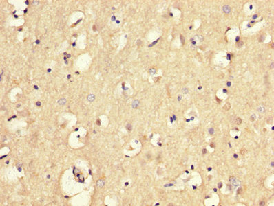 IHC image of CSB-PA013789LA01HU diluted at 1:300 and staining in paraffin-embedded human brain tissue performed on a Leica BondTM system. After dewaxing and hydration, antigen retrieval was mediated by high pressure in a citrate buffer (pH 6.0). S...