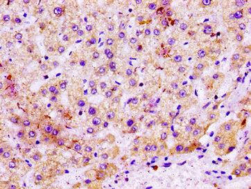 IHC image of CSB-PA013791LA01HU diluted at 1:100 and staining in paraffin-embedded human liver tissue performed on a Leica BondTM system. After dewaxing and hydration, antigen retrieval was mediated by high pressure in a citrate buffer (pH 6.0). S...