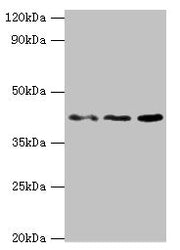 Western blot All lanes: MICA antibody at 8ug/ml Lane 1: MCF-7 whole cell lysate Lane 2: A431 whole cell lysate Lane 3: Mouse Stomach tissue Secondary Goat polyclonal to rabbit IgG at 1/10000 dilution Predicted band size: 43, 32 kDa Observed band s...