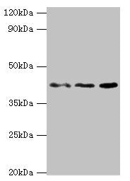 Western blot All lanes: MICA antibody at 8ug/ml Lane 1: MCF-7 whole cell lysate Lane 2: A431 whole cell lysate Lane 3: Mouse Stomach tissue Secondary Goat polyclonal to rabbit IgG at 1/10000 dilution Predicted band size: 43, 32 kDa Observed band s...