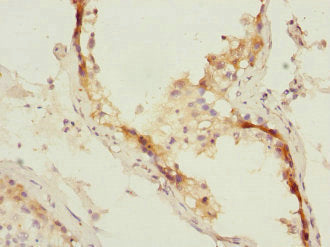 Immunohistochemistry of paraffin-embedded human testis tissue using CSB-PA013819ESR2HU at dilution of 1:100
