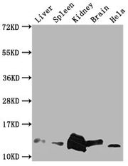 Western Blot Positive WB detected in: Mouse Liver tissue, Mouse Spleen tissue, Mouse kidney tissue, Mouse Brain tissue, Hela whole cell lysate All lanes: Mif antibody at 1:2000 Secondary Goat polyclonal to rabbit IgG at 1/50000 dilution Predicted...