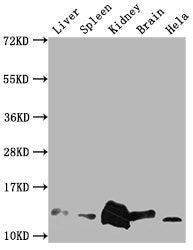 Western Blot Positive WB detected in: Mouse Liver tissue, Mouse Spleen tissue, Mouse kidney tissue, Mouse Brain tissue, Hela whole cell lysate All lanes: Mif antibody at 1:2000 Secondary Goat polyclonal to rabbit IgG at 1/50000 dilution Predicted...