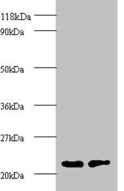 Western blot All lanes: proteasome subunit beta type-2 antibody at 2ug/ml Lane 1: EC109 whole cell lysate Lane 2: 293T whole cell lysate Secondary Goat polyclonal to rabbit IgG at 1/15000 dilution Predicted band size: 23 kDa Observed band size: 23...