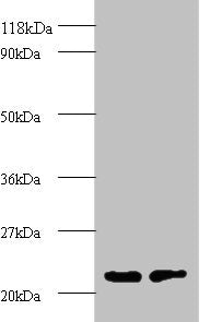 Western blot All lanes: proteasome subunit beta type-2 antibody at 2ug/ml Lane 1: EC109 whole cell lysate Lane 2: 293T whole cell lysate Secondary Goat polyclonal to rabbit IgG at 1/15000 dilution Predicted band size: 23 kDa Observed band size: 23...