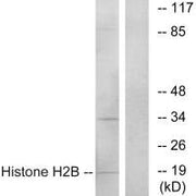 Western blot analysis of extracts from A549 cells, using Histone H2B antibody.
